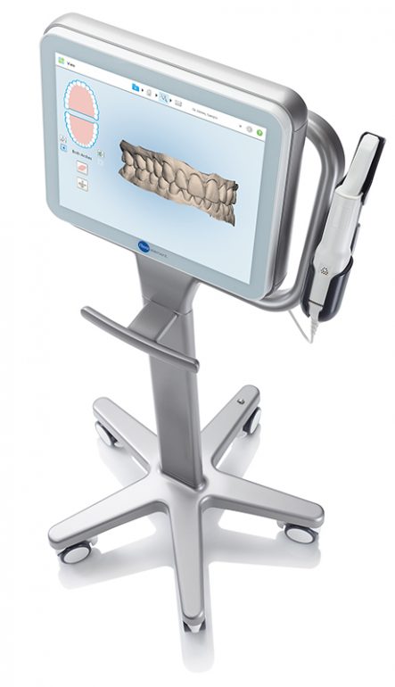 他のマウスピース型矯正との違い